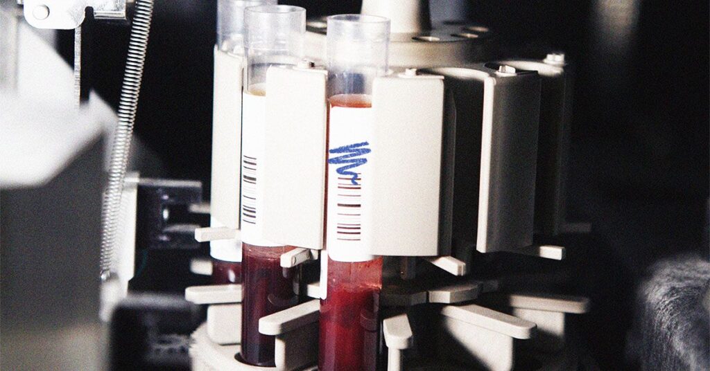 Des « signatures » protéiques dans un seul test sanguin pourraient aider à détecter plus de 60 maladies