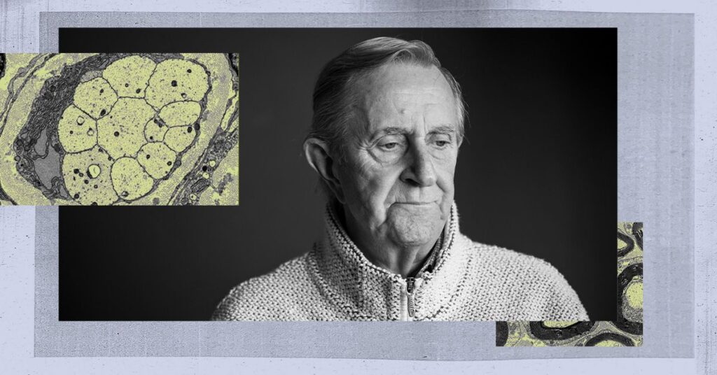 Une étude remet en question les idées actuelles sur la formation de plaques toxiques dans la maladie d'Alzheimer