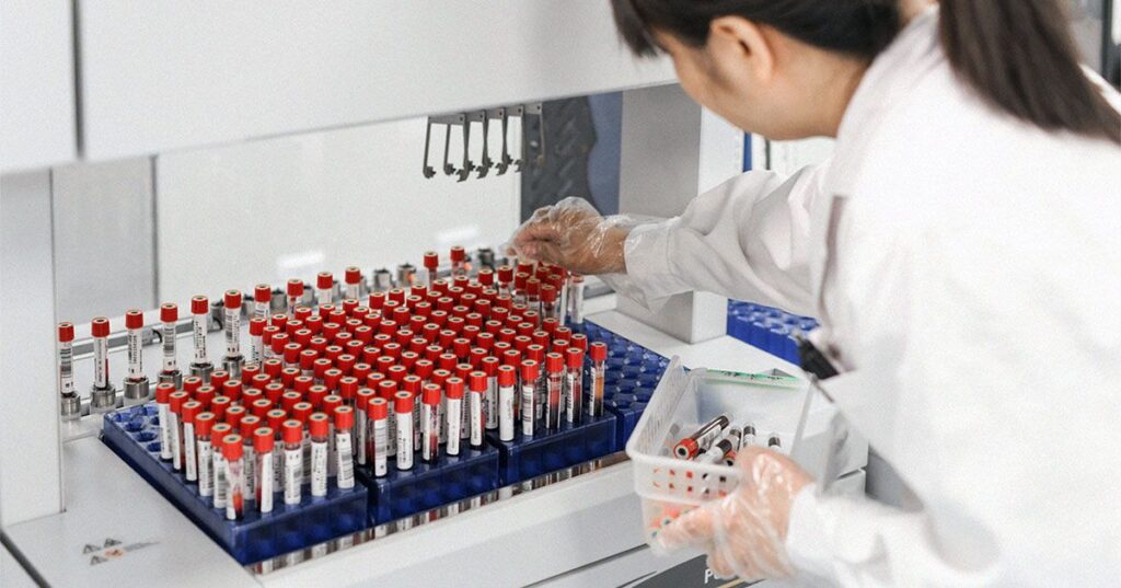 Les tests sanguins sur la maladie d'Alzheimer montrent une "très bonne précision" dans les premiers essais