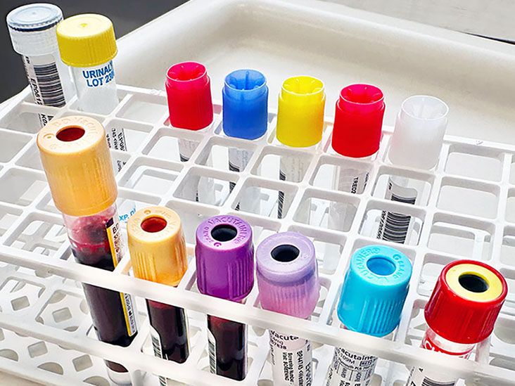 Test tubes of blood for a clinical trial at a hospital