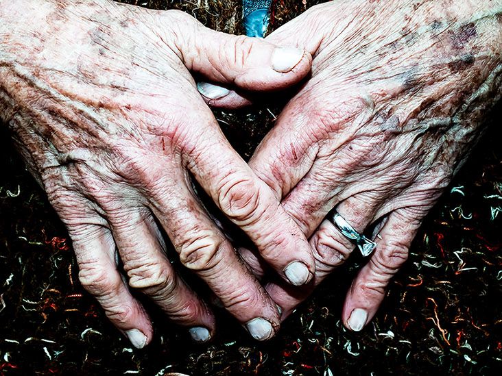 An older person
