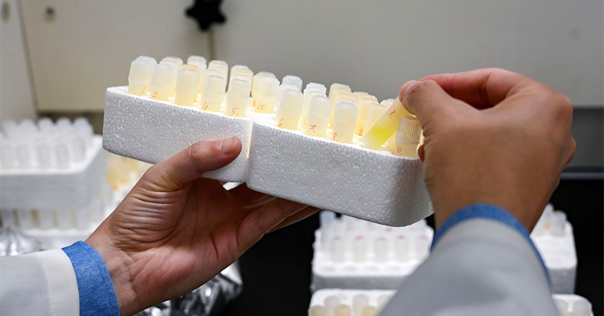 L'Alzheimer est liée à de faibles niveaux de lithium cérébral, montre l'étude