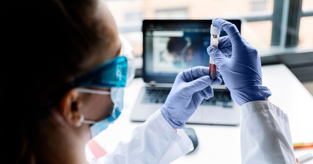 Un nouveau test sanguin pourrait aider à diagnostiquer le syndrome de fatigue chronique avec une précision de 96 %