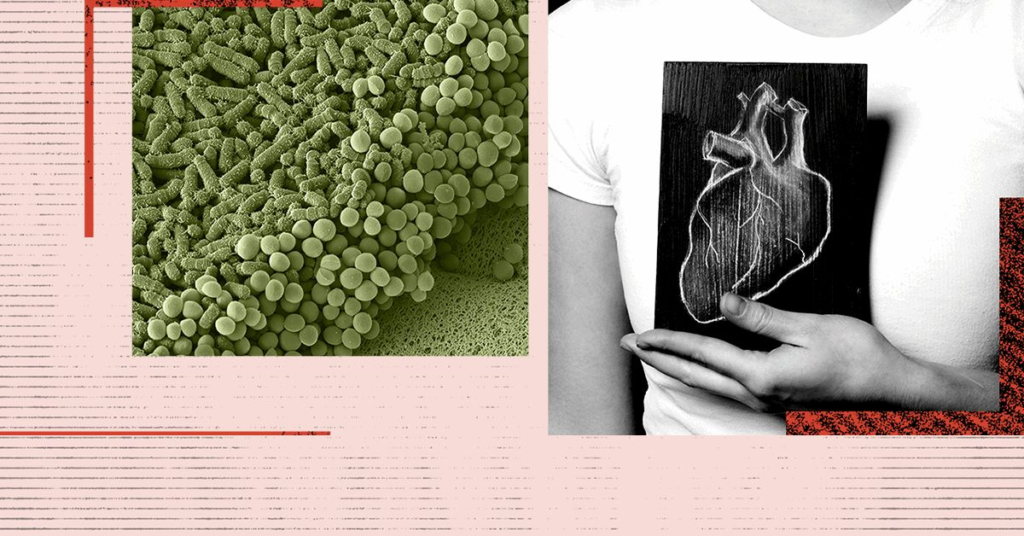 Les changements dans les bactéries intestinales peuvent être un signe avant-coureur d’une maladie cardiaque