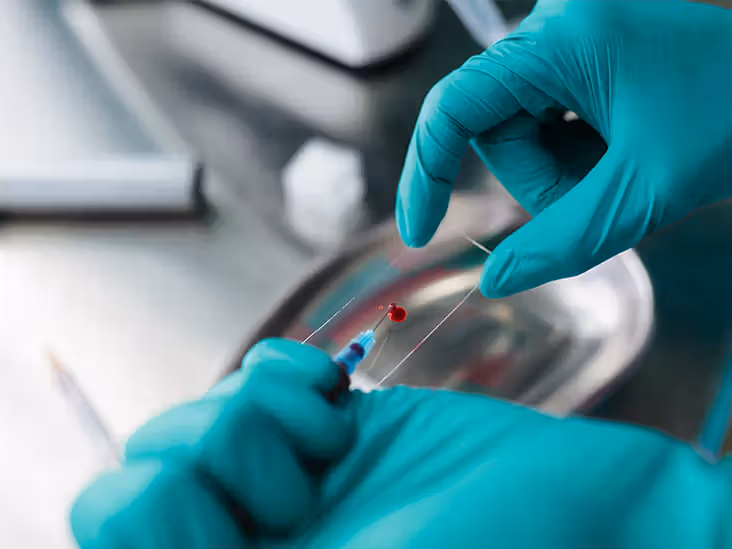 Les nouvelles lignes directrices sur le dépistage du cancer colorectal ajoutent des analyses de sang et de selles à domicile