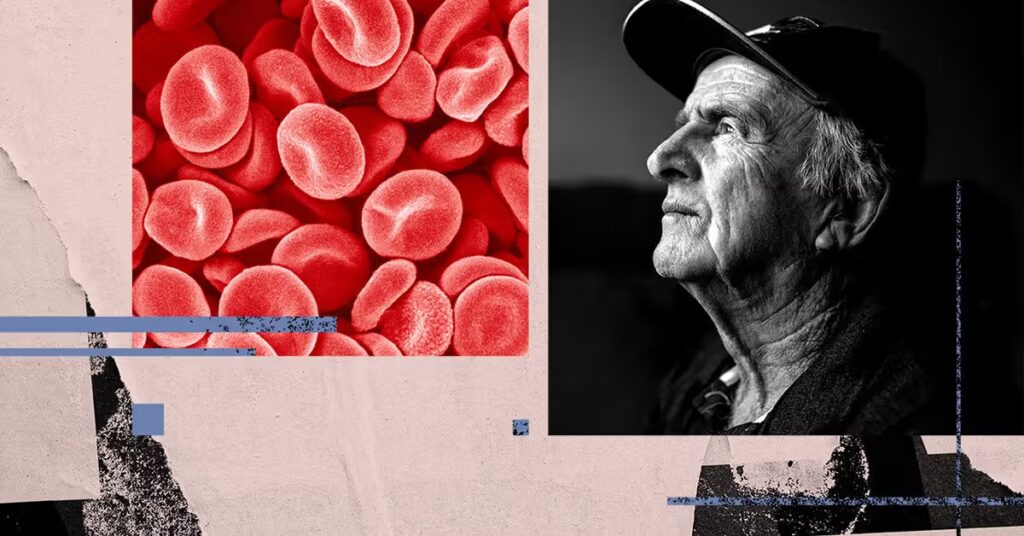 Un test sanguin mesurant l'âge biologique pourrait révéler un risque de démence