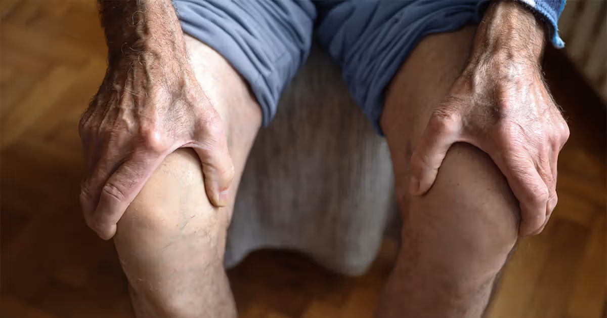 La chirurgie pourrait aggraver l’arthrose du genou, selon une étude, alors qu’est-ce qui pourrait aider ?