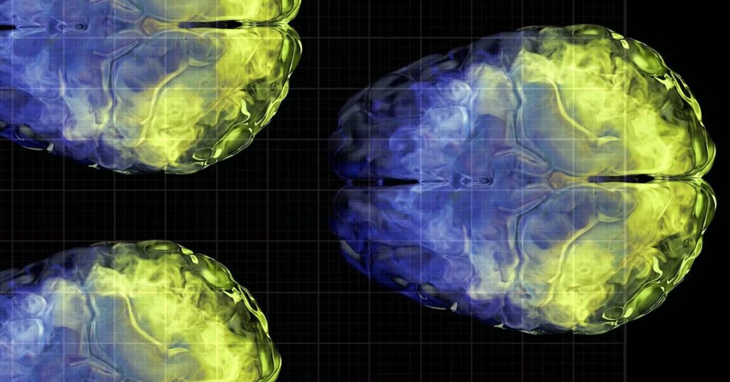 La vitamine C pourrait aider à préserver le volume de matière grise du cerveau à mesure que nous vieillissons