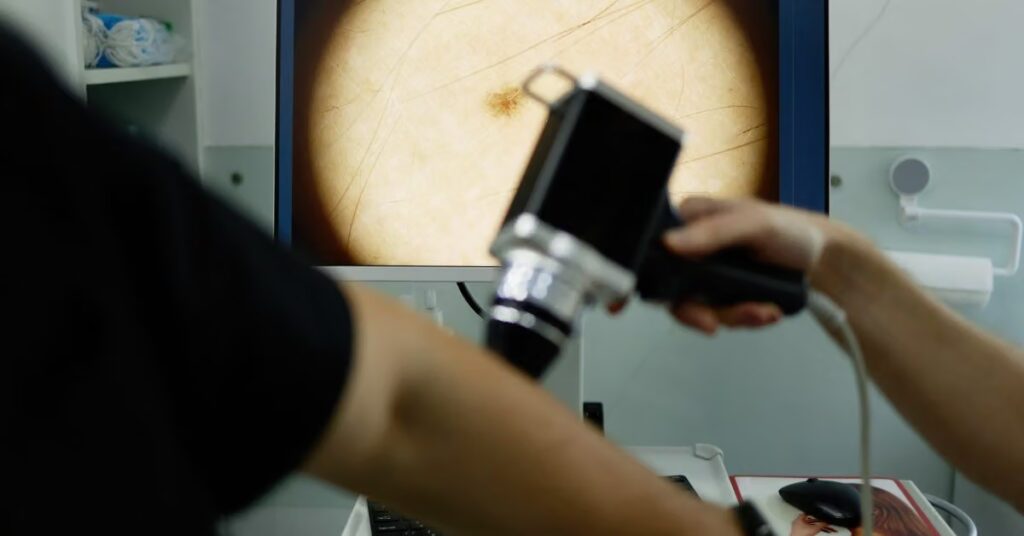 Contrôles du cancer de la peau : ce que l'IA peut aider à détecter – et comment se contrôler à la maison
