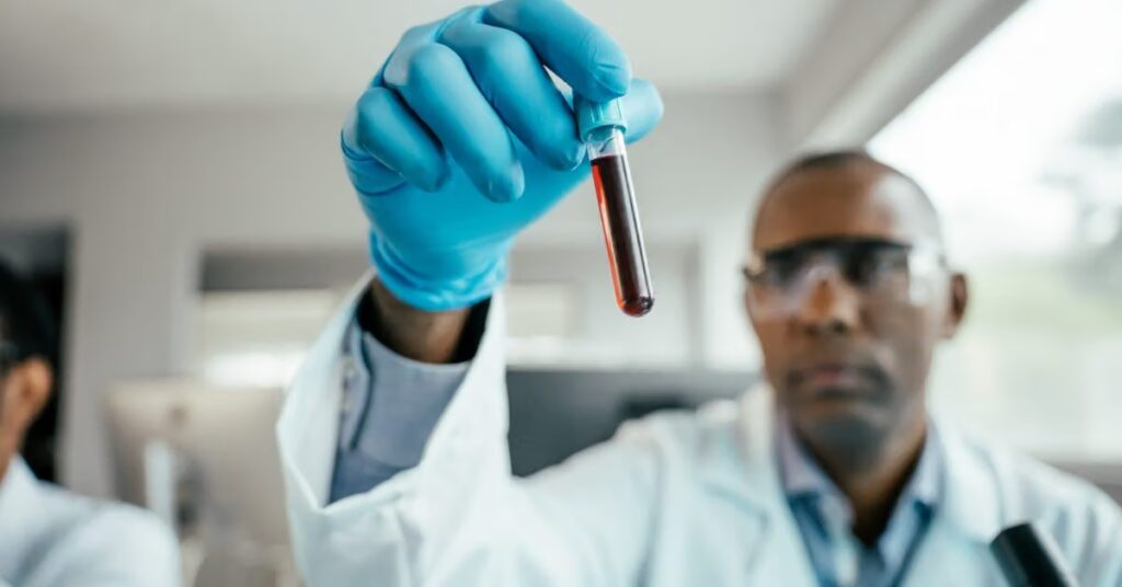 Un test sanguin pourrait détecter une récidive du cancer du poumon des mois avant les analyses
